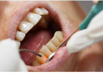 पूरे शरीर को प्रभावित कर सकती है दांतों और मसूडों की समस्या