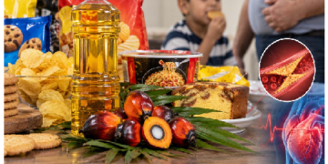 Palm Oil Health Risks: ज्यादा पाम ऑयल वाले पैकेटबंद खाद्य पदार्थों का सेवन कितना नुकसानदायक?