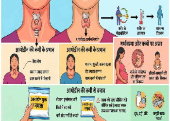 आयोडीन की कमी से हो सकती हैं गंभीर बीमारियां, जानें लक्षण और बचाव के उपाय